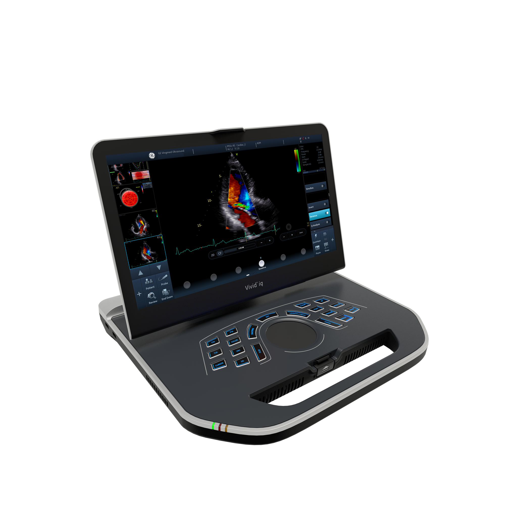 Vivid iQ GE HealthCare, vista lateral