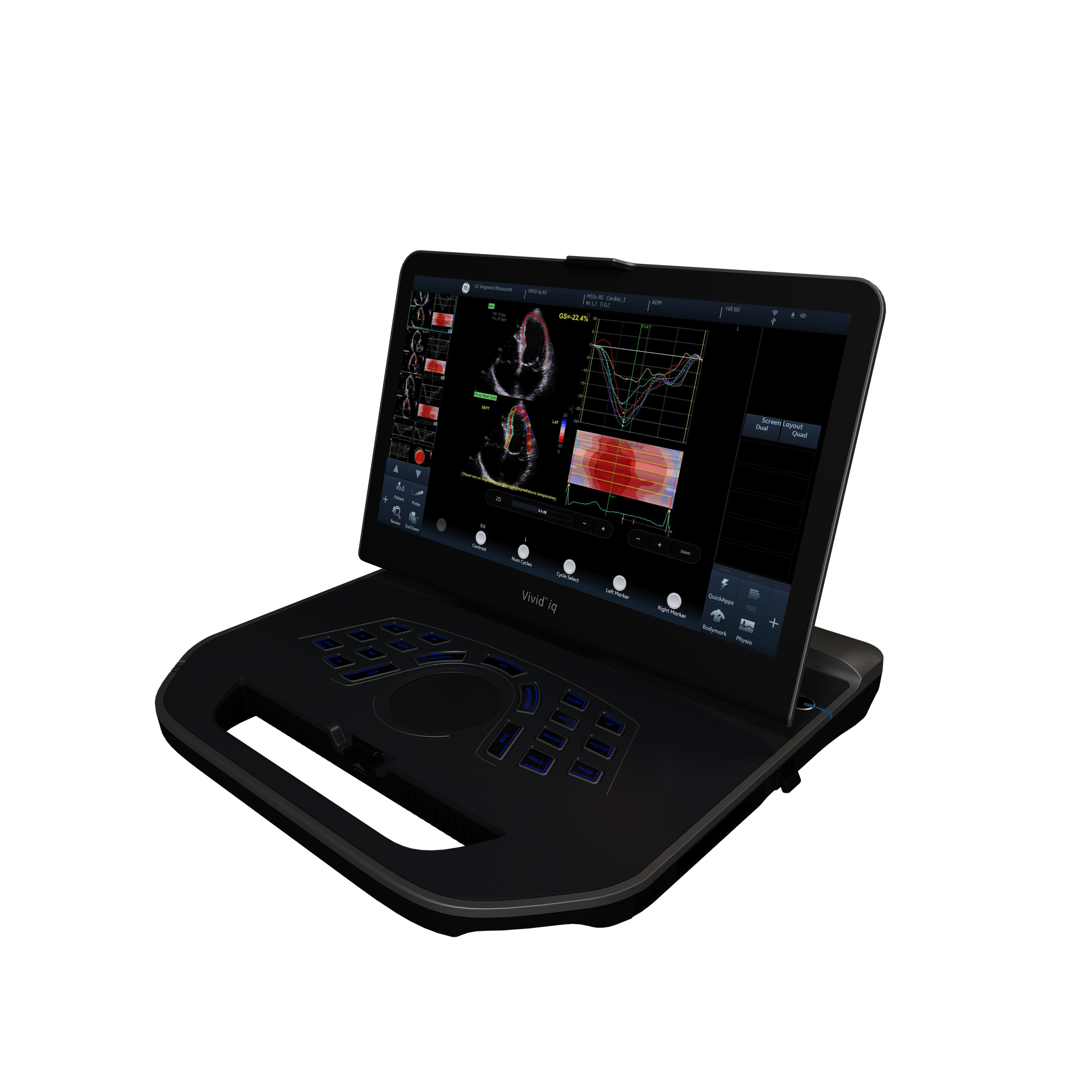 Vivid iQ GE HealthCare, vista em perspectiva